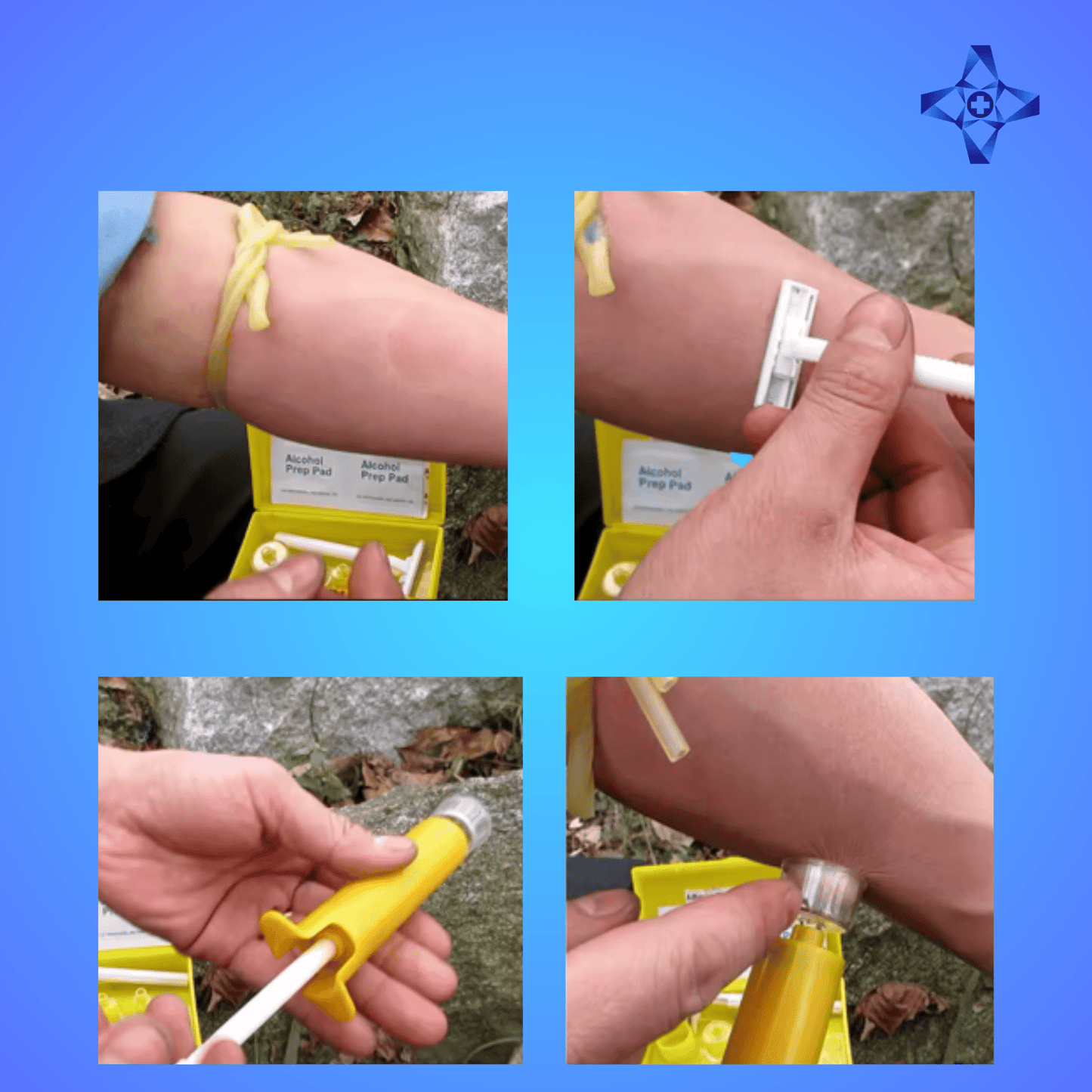 Extractor de Veneno para Mordeduras y Picaduras